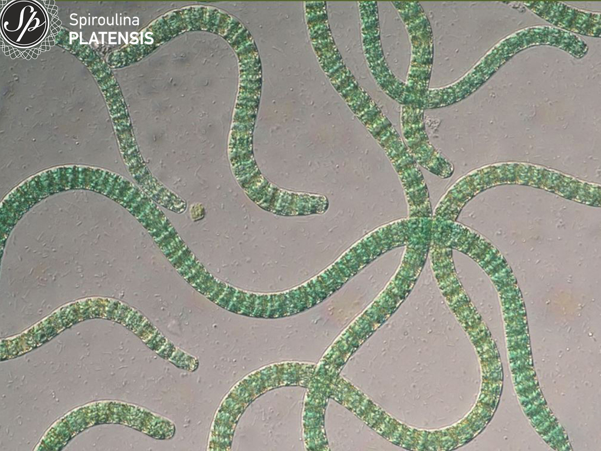 Εικόνα spiroulina PLATENSIS από μικροσκόπιο